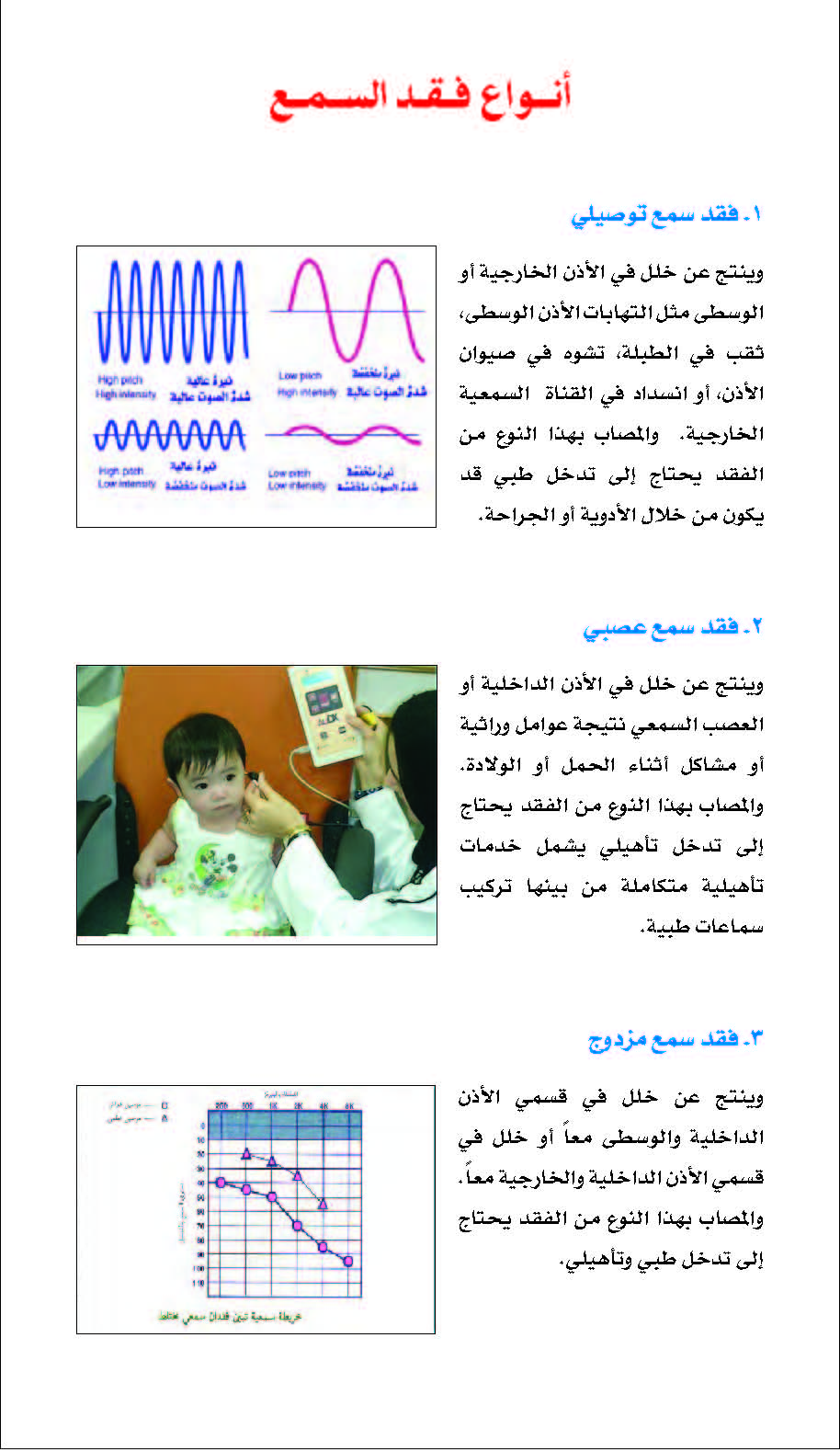  فقد السمع-1